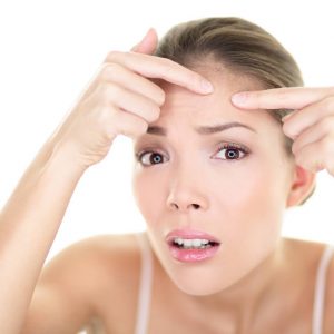 Pelli impure o tendenti all’acne